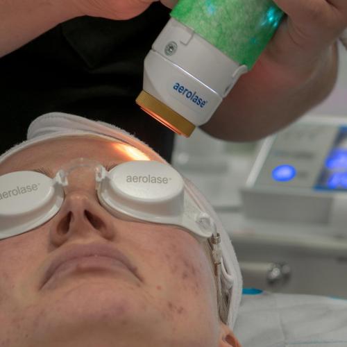  Laser acne treatments and skin care: say goodbye to acne and other skin conditions 